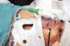 Ramdev supporter Rajbala succumbs to injuries