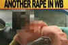 Bengal: Doctor rapes 18-year-old deaf and dumb woman