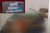Shocking: Minor raped, set on fire in Barabanki