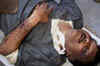 32 torture marks on body of murdered UP engineer