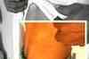 Tamil Nadu: Kidney racket exposed