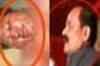 Woman set ablaze by SP MLA dies