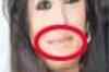Raveena's lip job ruined!