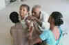 Bizarre ritual: Kids branded with hot copper rods